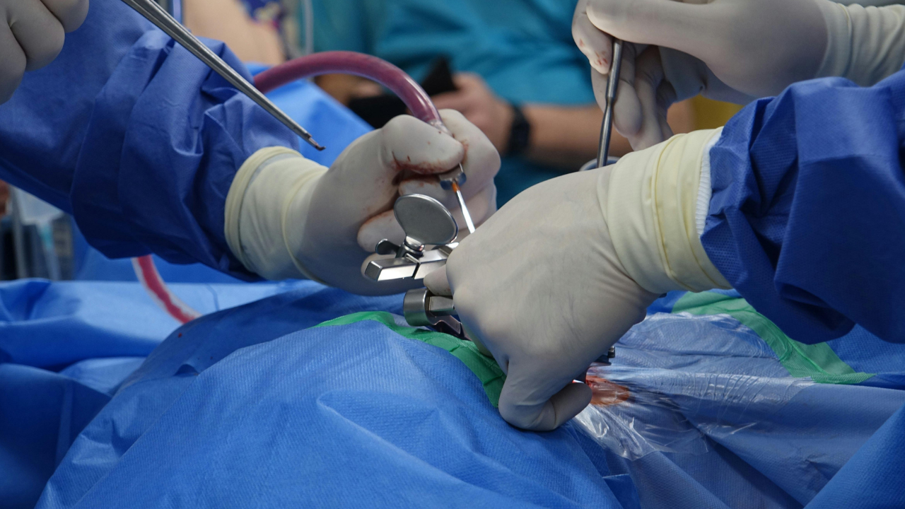 Omurga Osteoartriti için Kök Hücre Tedavisi
